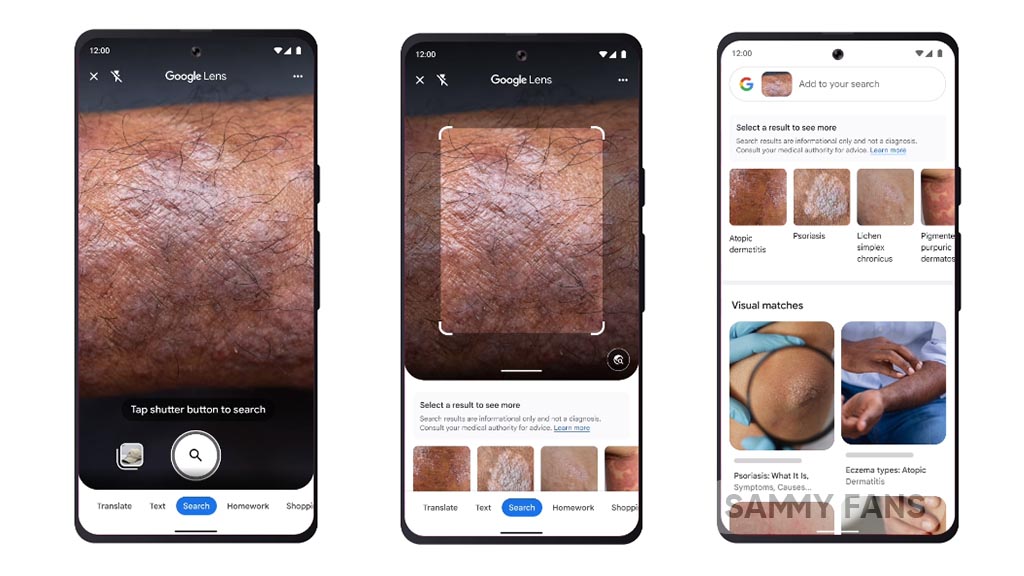 Google Lens now helps you to identify your skin condition Sammy Fans